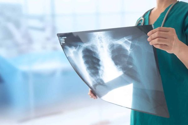 X-Ray-Diagnostics