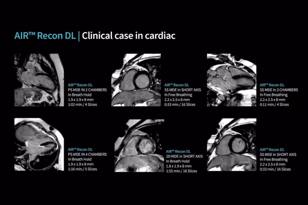 Cas clinique en cardiologie